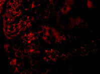 IF - AGTR1 Antibody ASC10977